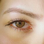 wrinkle treatment near me