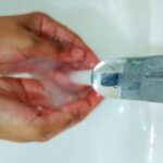 hyperhidrosis specialist near me