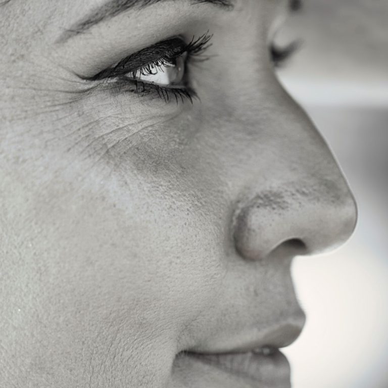 Fine lines and wrinkle Treatemnt